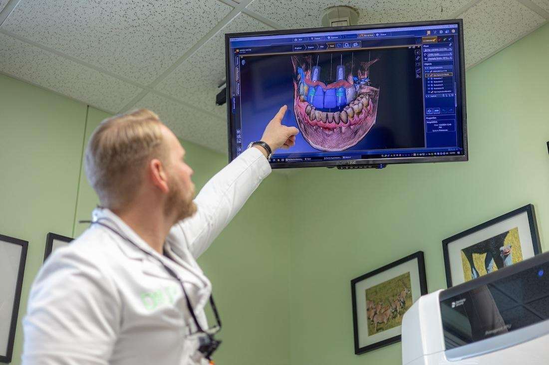 3D Dental Scan for digital planning of implants and crowns at dentistry @ university pointe, west chester oh